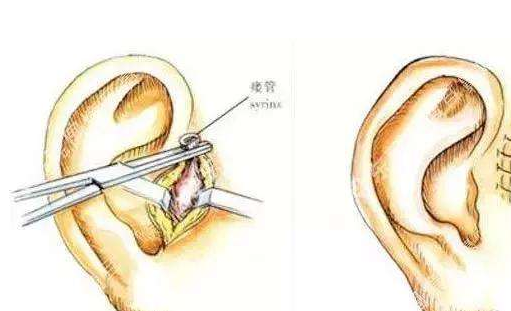 ��ǰ���ܷ��������ŧ